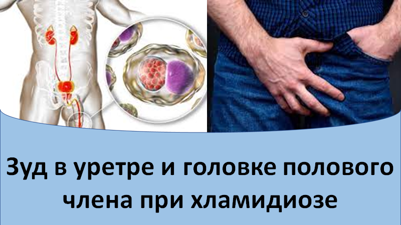 Зуд в уретре и головке полового члена при хламидиозе смотреть онлайн