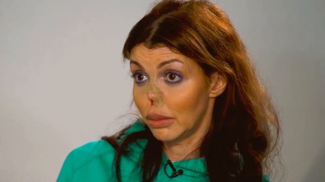 КАКОЙ УЖАС! БОЛЬНО СМОТРЕТЬ! Как сейчас живет и выглядит тяжелобольная Алиса Аршавина? смотреть онлайн