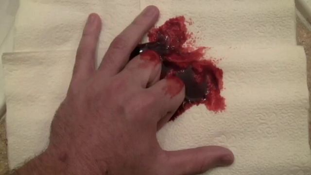 Fingers cut off (GRAPHIC) смотреть онлайн