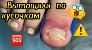 Вытащили по кусочкам?⚠️?❗️??