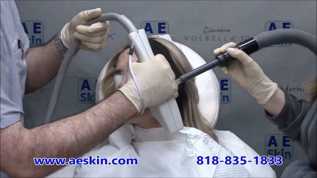 Forever Young BBL IPL Photofacial Demonstration 24 - A E Skin - Encino, CA - 818-835-1833