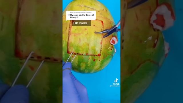 @fleetingfilms | Fruit & Vegetable Surgeries | Discount Dentist | TikTok Compilation смотреть онлайн