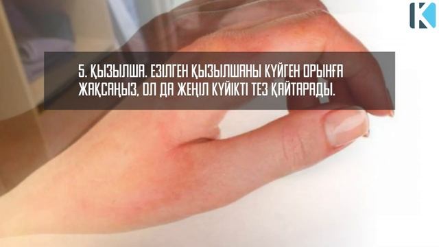 Күйген жерді қалай емдеуге болады, КҮЙІП ҚАЛСАҢЫЗ АЛҒАШҚЫ ЖАСАУ КЕРЕК АМАЛДАР, Керек арнасы смотреть онлайн