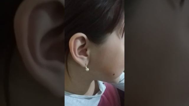 Шатается зуб ⭐⭐⭐ смотреть онлайн