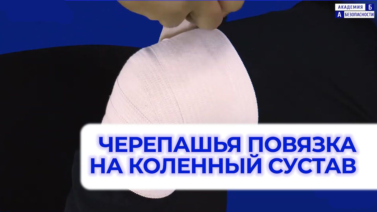 Наложение черепашьей расходящейся повязки на коленный сустав смотреть онлайн