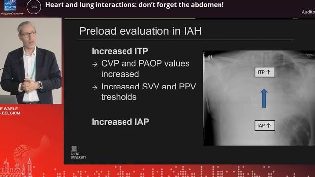 Heart and lung interact and abdomen J. De Waele (ESICM 23)
