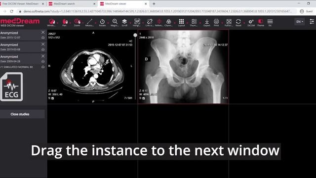 MedDream DICOM Viewer: introduction смотреть онлайн