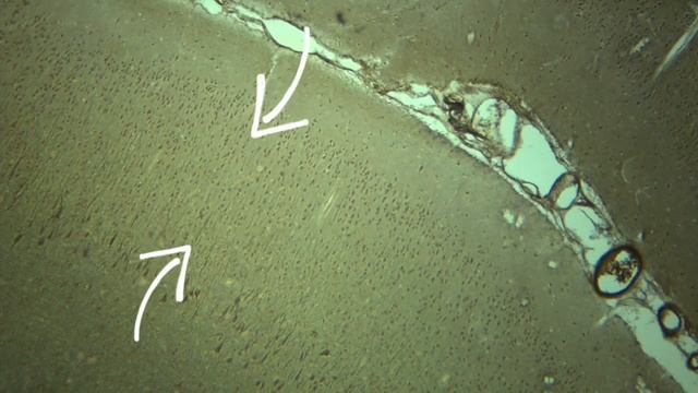 Разбор гистологических препаратов: Кора больших полушарий