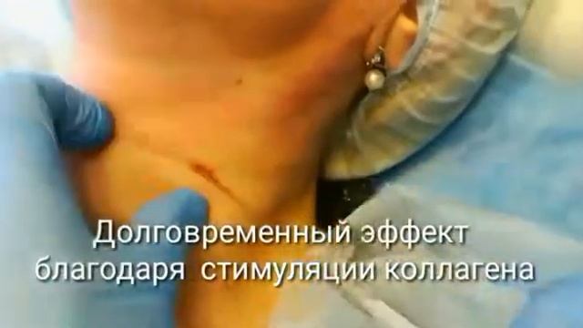 Радиесс смотреть онлайн