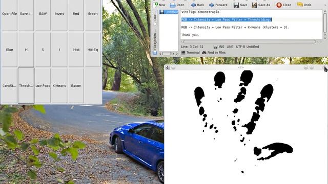 Computer Vision Algorithms Applied to vitiligo detection смотреть онлайн