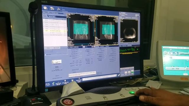 LIVER 3-PHASE (triphasic) MRI Scan 🏥☢ -3Tesla смотреть онлайн