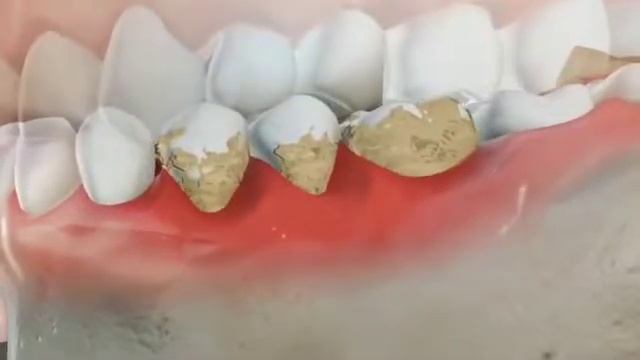 как бороться с запахом изо рта смотреть онлайн