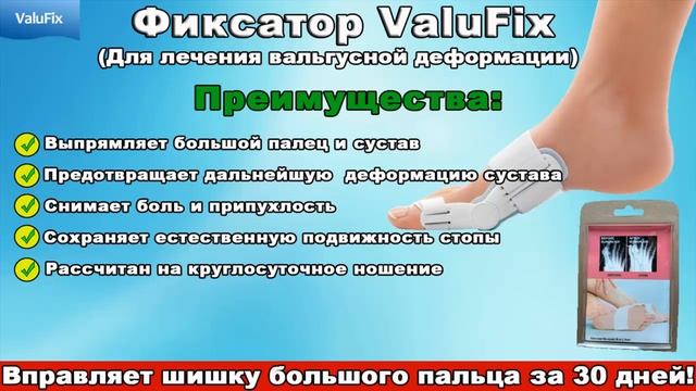 Валюфикс фиксатор ValuFix Отзывы смотреть онлайн