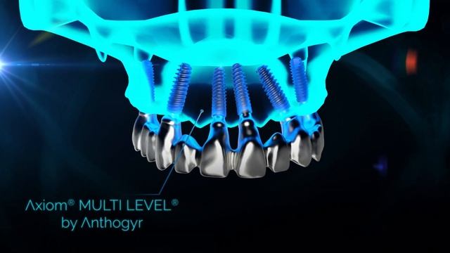 Anthogyr Axiom® Multi Level® - EN смотреть онлайн