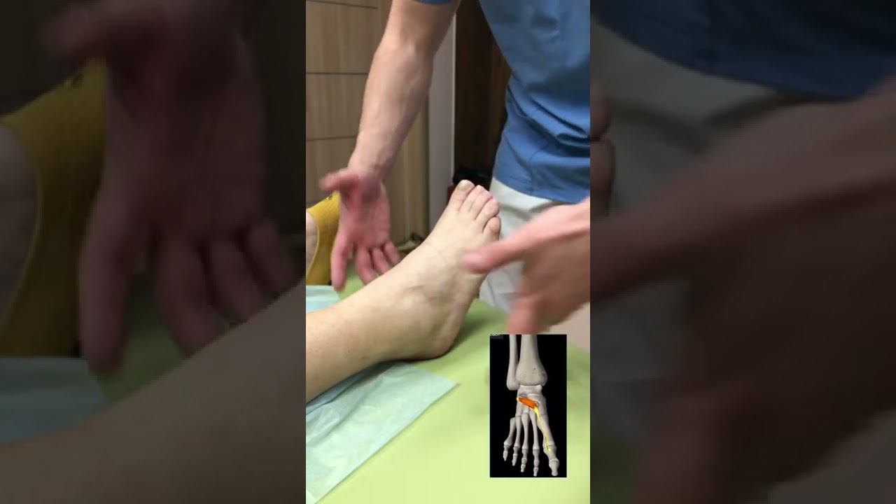 Как работают наши мышцы? Причины мышечной слабости?