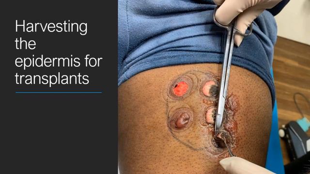 Vitiligo смотреть онлайн