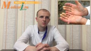 Болезнь Рейно. Причины, симптомы и лечение