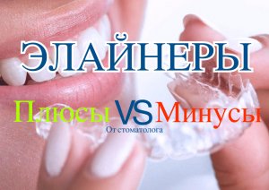 Элайнеры плюсы и минусы