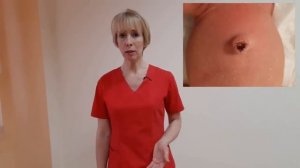 Как завязывают пупок? Что делают с пуповиной новорожденного в род.доме © Шилова Наталия