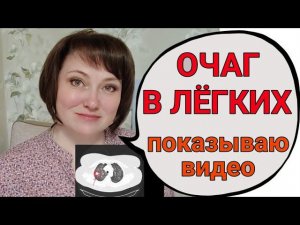 Показываю свою "новую" опухоль в легких? Видео сравнение ПЭТ КТ и прошлых КТ.