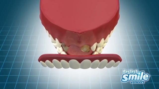 Виниры для зубов Perfect Smile Veneers на сайте unikum-store.ru смотреть онлайн