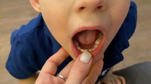 Зубы шатаются. Скоро придёт зубная фея )