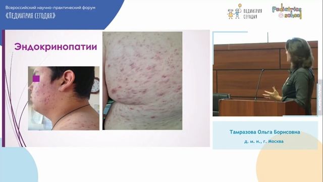 Угревая болезнь у детей и подростков смотреть онлайн