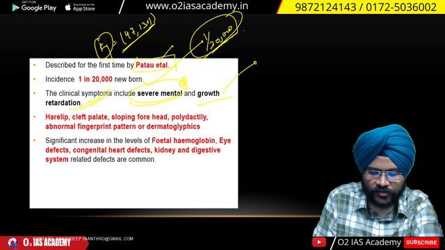 Anthropology - Chromosomal Aberrations - Patau Syndrome for UPSC Mains 2022 | Anthro Class - 81 смотреть онлайн
