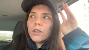 Лазерная шлифовка лица (ЧАСТЬ 2). Моя история. Лазер СО2.