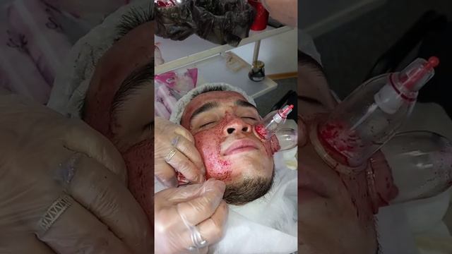 Хиджама на лицо 2 часть смотреть онлайн