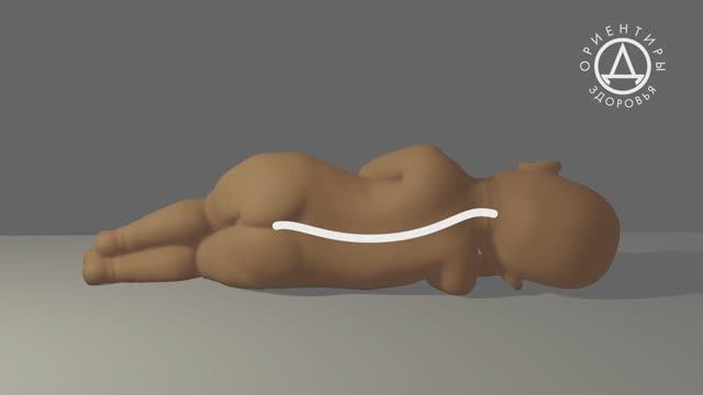 Как не пропустить ортопедические отклонения у ребенка смотреть онлайн