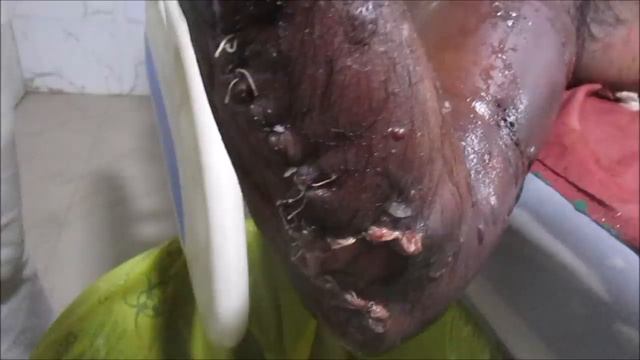 Gas Gangrene смотреть онлайн