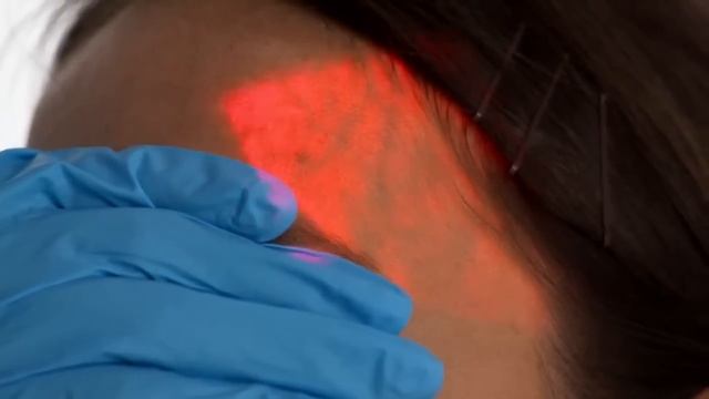 Аппарат AccuVein AV400 для косметических процедур