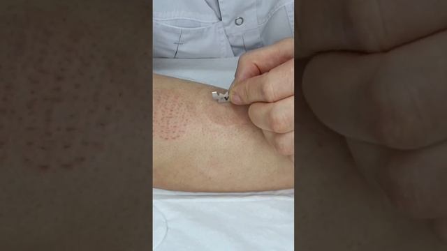 Хиджама самому себе за 7 минут смотреть онлайн