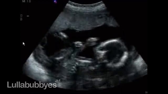 ?SHHH SHH! ❤️ WOMB SOUNDS ? WHITE NOISE BABY ? HEARTBEAT ♫ Comforting Womb Sounds