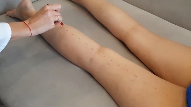 Доктор Врач/САМАЯ ПОПУЛЯРНАЯ ПРОЦЕДУРА КРАСОТЫ/ЧТО ТАКОЕ ЛИМФОСТАЗ И ЧЕМ ОН ОПАСЕН