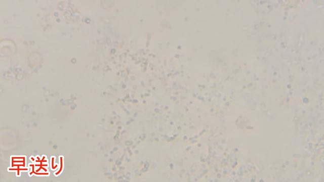 細菌に白血球を落とすと… смотреть онлайн