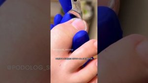 Как правильно стричь ногти детям?