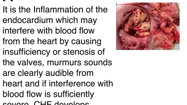 4 Hydropericardium смотреть онлайн