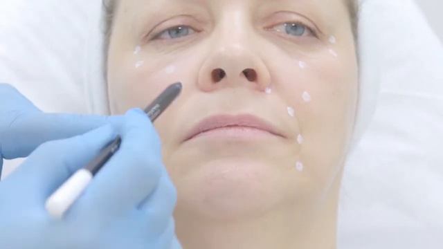 Hyalrepair Super Lift