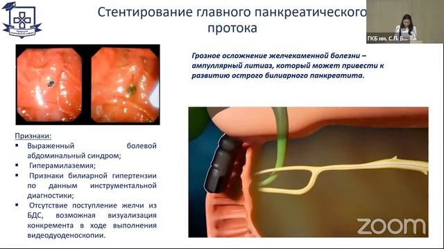 СНО "Будущий Московский хирург" 27 мая 2021г. смотреть онлайн