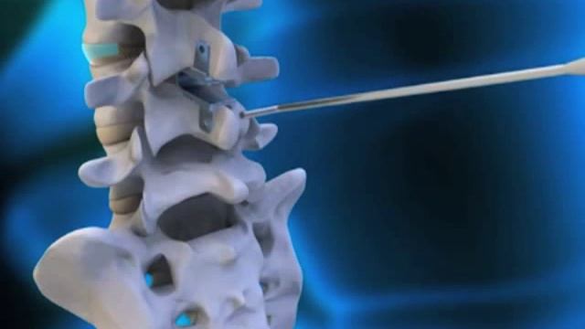 Coflex-f смотреть онлайн