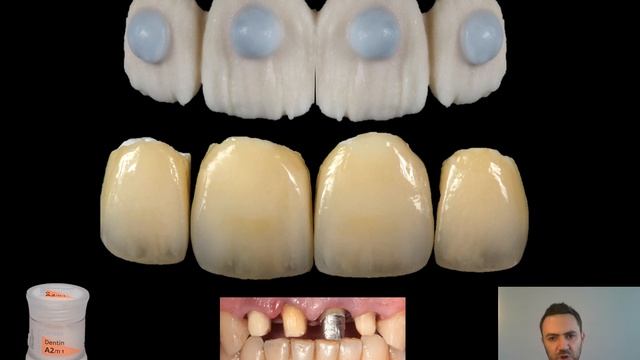 HO ingot … balancing between the opacity of the frame and the translucency of the powders смотреть онлайн