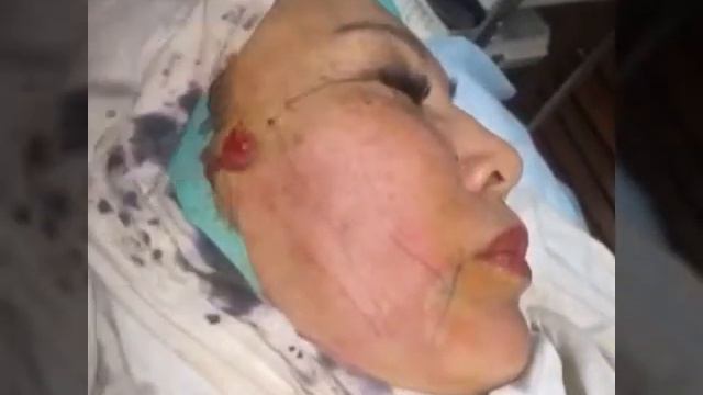 Нити Аптос смотреть онлайн
