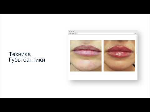 Вебинар-хит! Авторская техника КП «Губы-бантики» смотреть онлайн