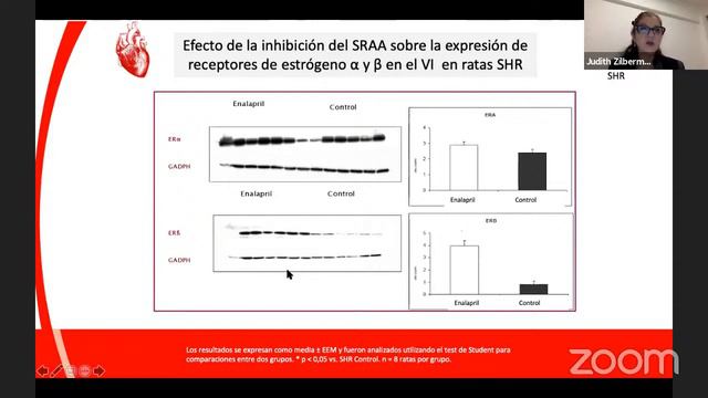 Seminarios Virtuales de Investigación Básica y Clínica en HTA y Daño de Órgano Blanco смотреть онлайн