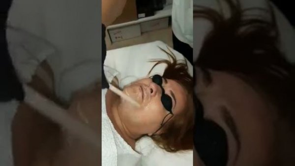 LASER LED LXD #laser #laserled