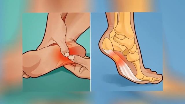 Болят ПЯТКИ УТРОМ или когда вы ВСТАЕТЕ? Вот, что вам НУЖНО СДЕЛАТЬ! смотреть онлайн