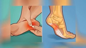 Болят ПЯТКИ УТРОМ или когда вы ВСТАЕТЕ? Вот, что вам НУЖНО СДЕЛАТЬ!