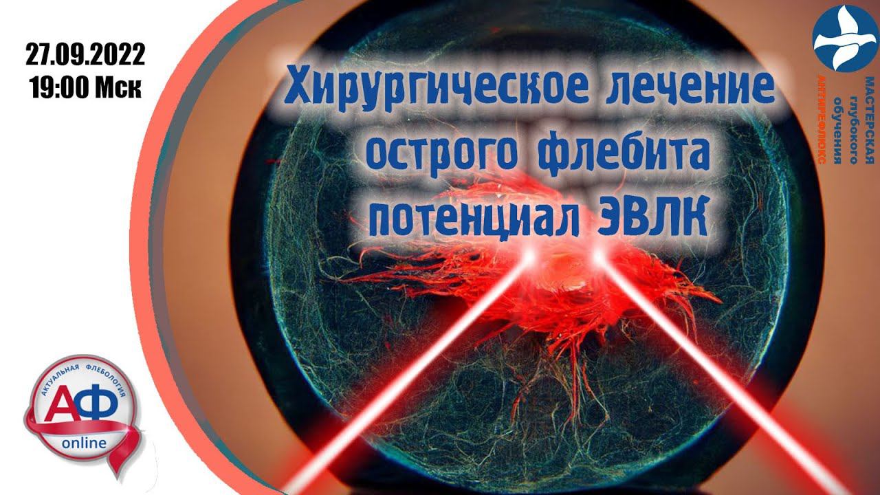 ЭВЛК при флебите смотреть онлайн